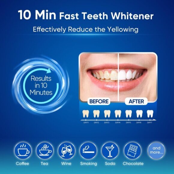 NEW MySmile Teeth Whitening Kit - Picture 4 of 6